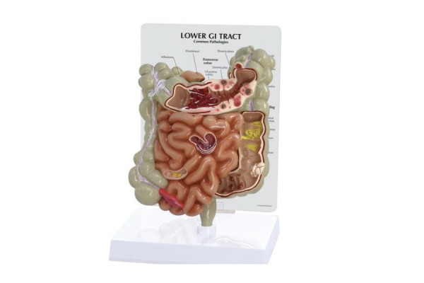 model przewodu pokarmowego - 1019556 3b scientific modele anatomiczne 2